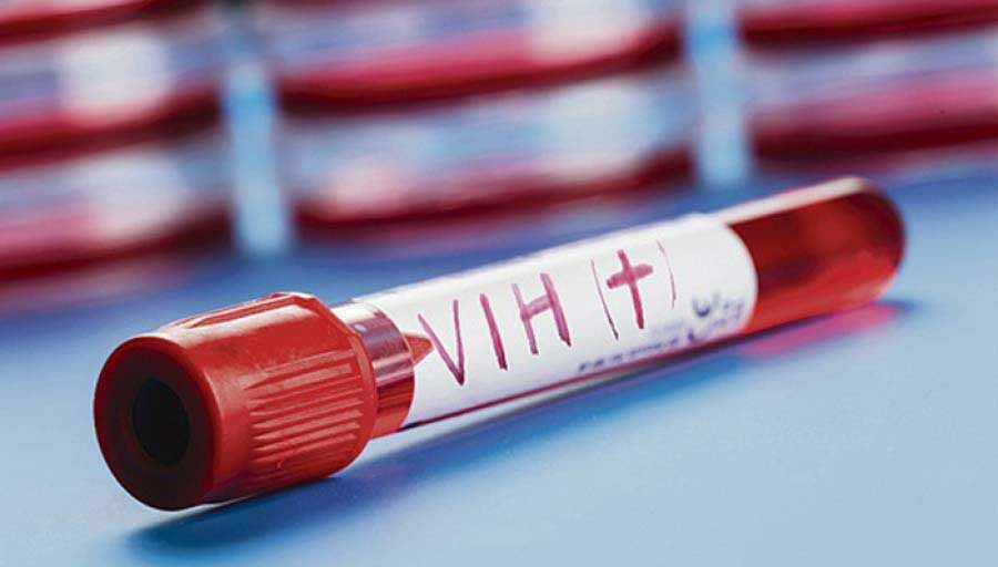 Cepa del virus HIV en Argentina es resistente a los tratamientos