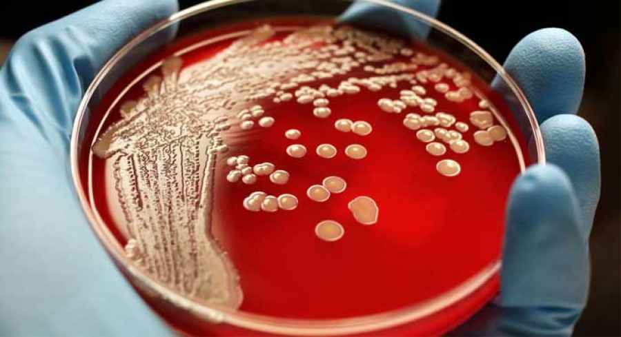 Un antibi&oacute;tico com&uacute;n podr&iacute;a tratar el estafilococo resistente a la meticilina