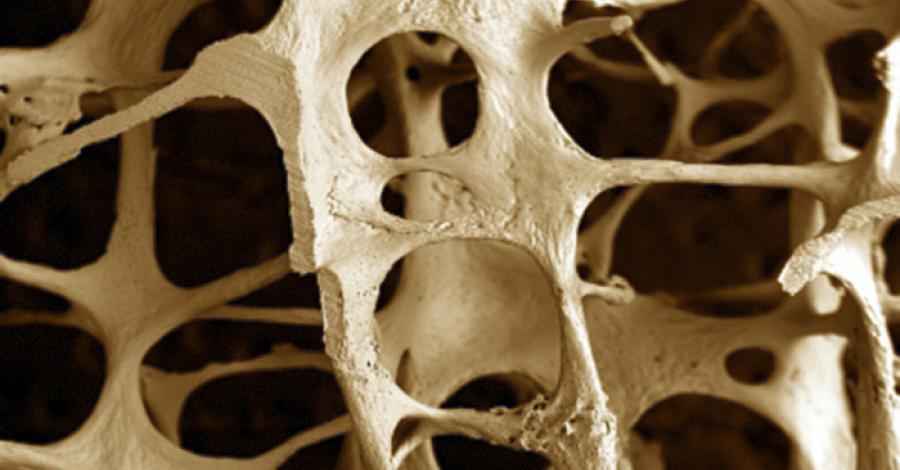 Un material diseñado en laboratorio replica el tejido óseo humano con precisión