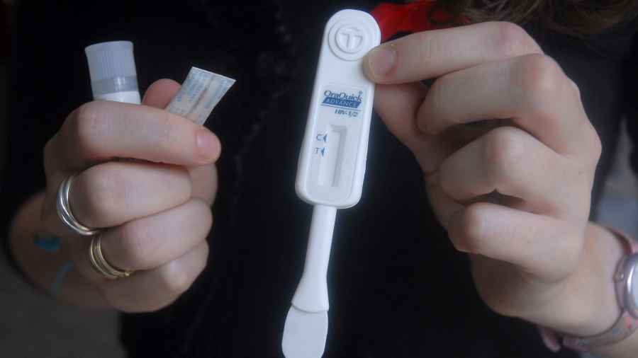 Desarrollan un nuevo método de detección oral del VIH “más sensible”
