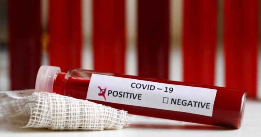 Factor sanguíneo y Covid-19