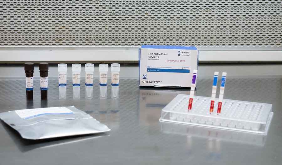 Anmat aprobó dos nuevos test para Covid-19