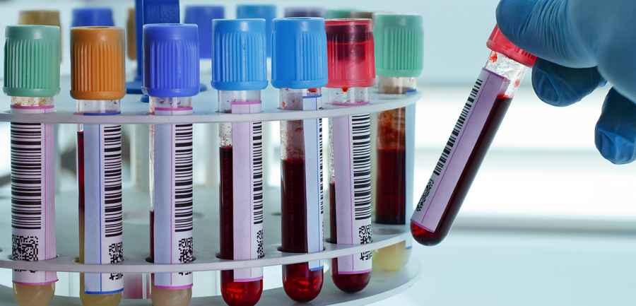 Crearon un test de sangre capaz de detectar de forma temprana ocho tipos de c&aacute;ncer