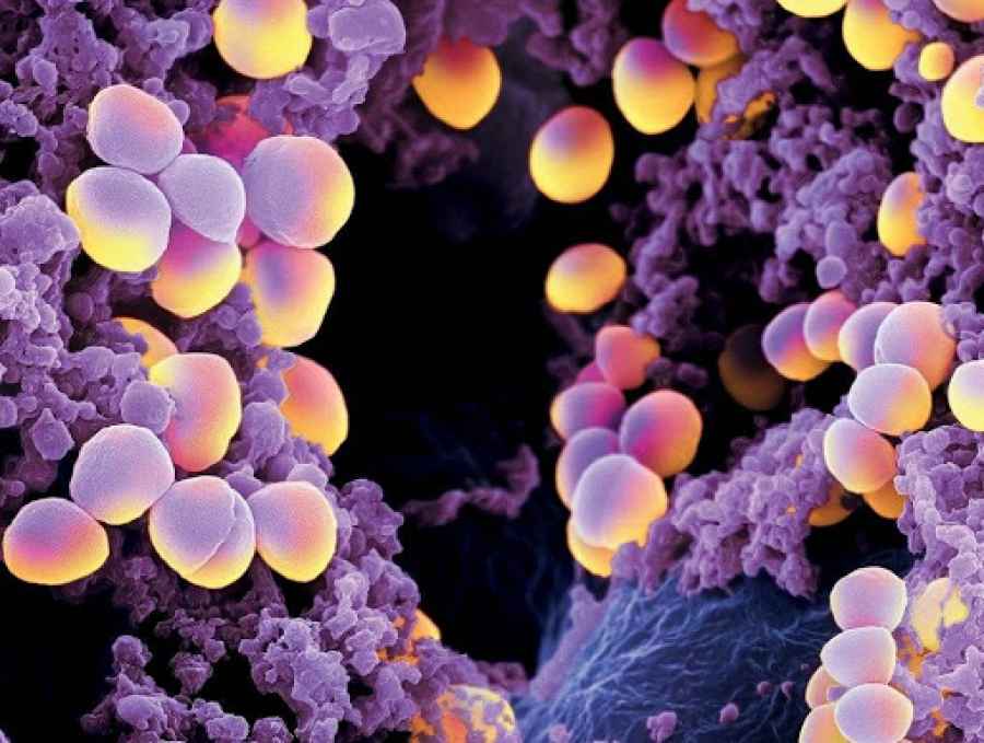 Antibi&oacute;tico de tipo "lego" para vencer bacterias resistentes