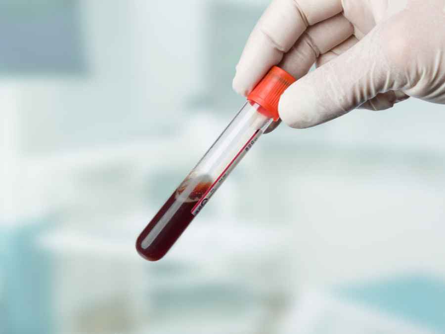 Mielona m&uacute;ltiple: nueva combinaci&oacute;n farmacol&oacute;gica retarda su avance