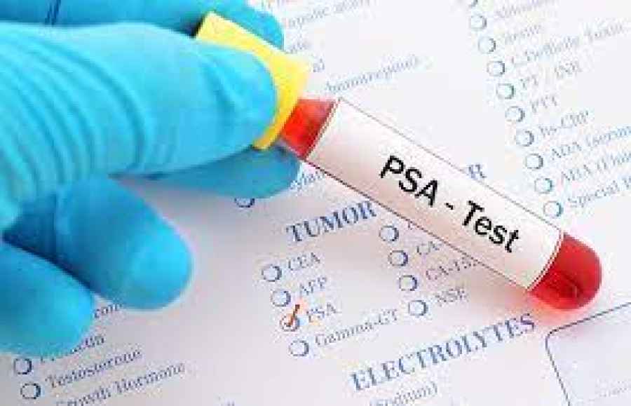 La importancia de la detección temprana en el cáncer de próstata