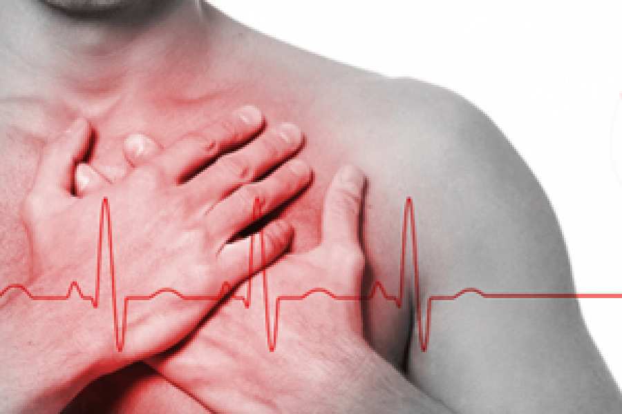 Es el promedio en el 50% de los casos. Hay demoras de hasta 24. El ideal es menos de 2.