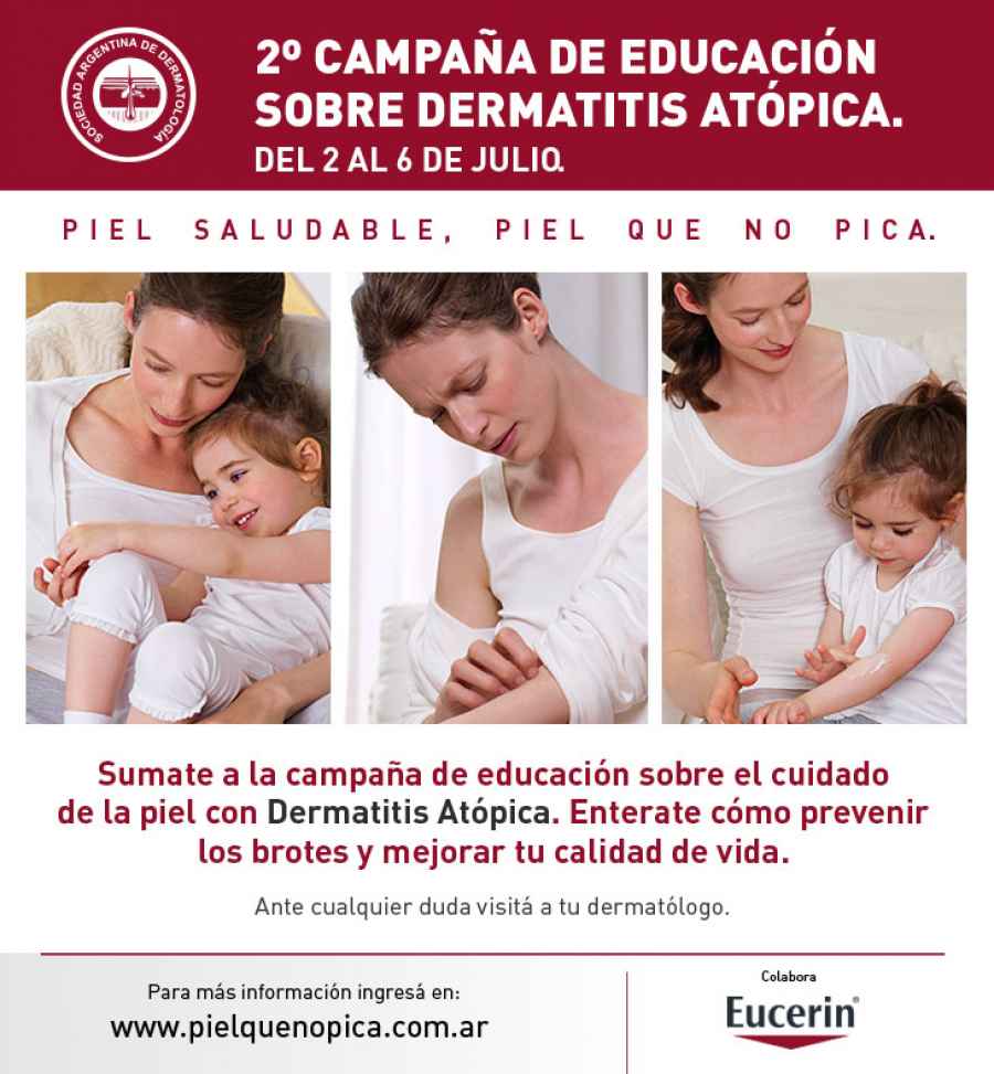 La Sociedad Argentina de Dermatolog&iacute;a junto con la colaboraci&oacute;n de Eucerin llevar&aacute; a cabo la 2&deg; Campa&ntilde;a de Educaci&oacute;n sobre Dermatitis At&oacute;pica bajo el lema &ldquo;piel saludable, piel que no pica&rdquo;.