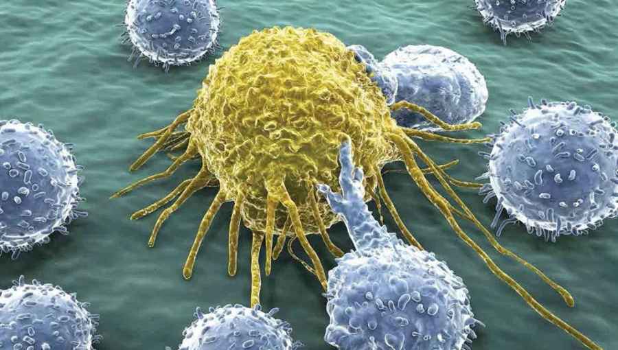 Identifican el papel de las c&eacute;lulas inmunes en la formaci&oacute;n de met&aacute;stasis