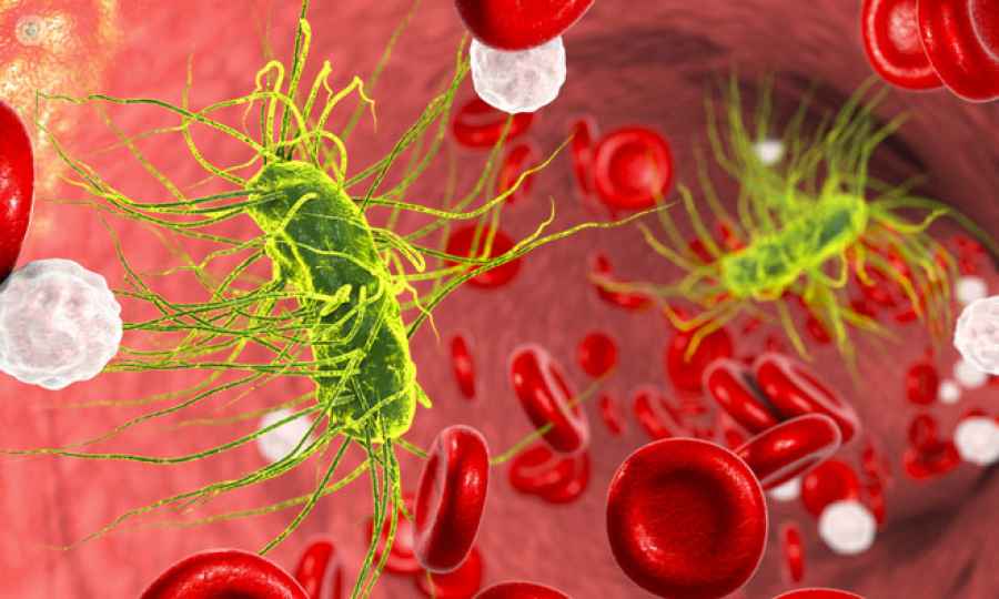 Niños, más susceptibles a las sepsis