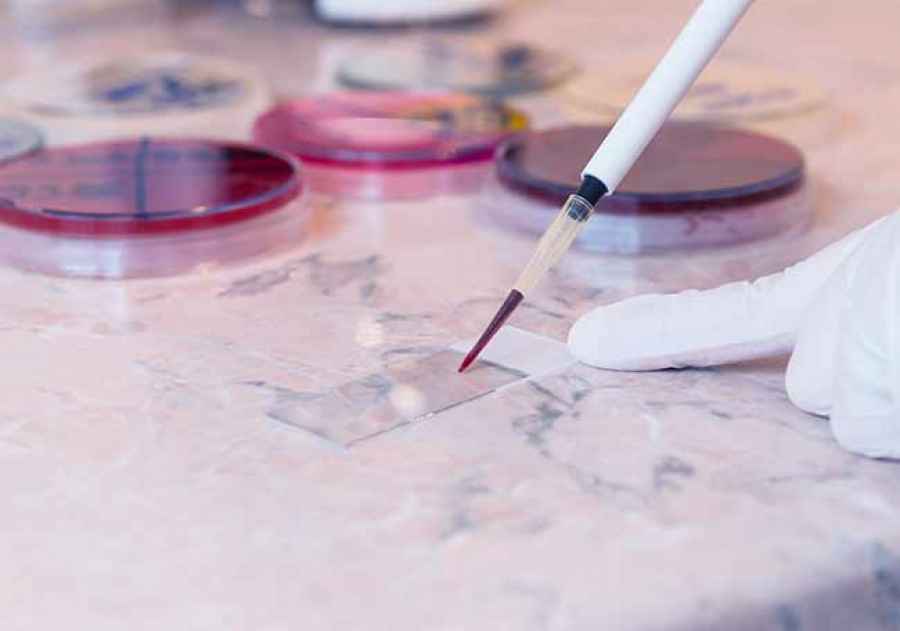 La Comisi&oacute;n Europea aprueba XOSPATA