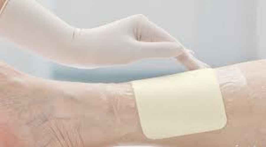 Una “biopelícula” antibiótica ayudará a regenerar la piel