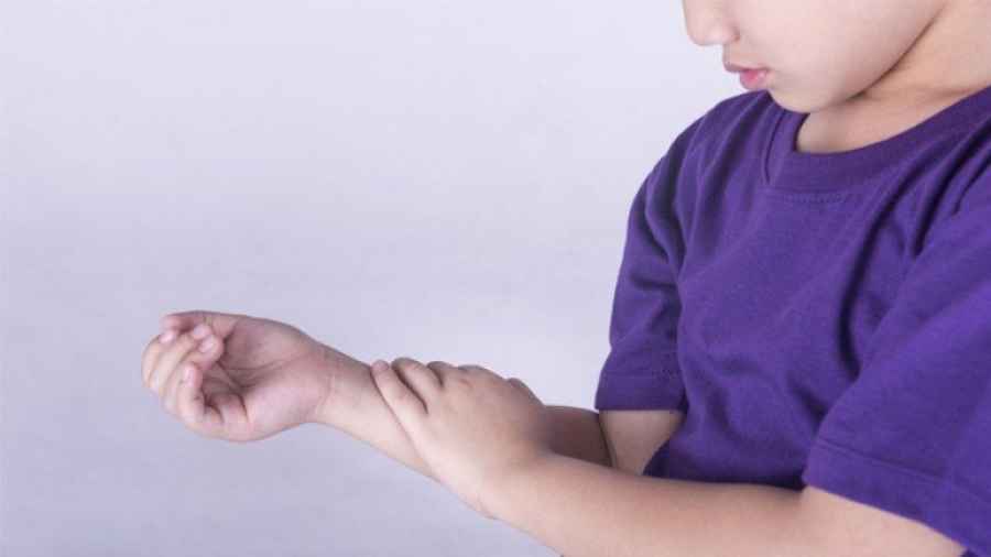 Artritis en niños y adolescentes