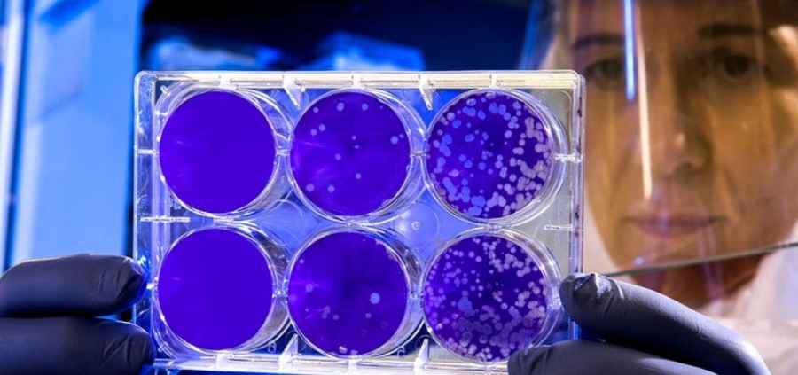 Se trata del molnupiravir, cuyos estudios comenzaron el año pasado por parte de investigadores de la Universidad de Georgia. Qué efectividad tendrá, según los especialistas