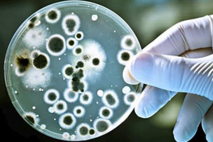 Una investigaci&oacute;n del IBR publicada en una revista de prestigio internacional abre las puertas al dise&ntilde;o de nuevos f&aacute;rmacos para vencer infecciones letales