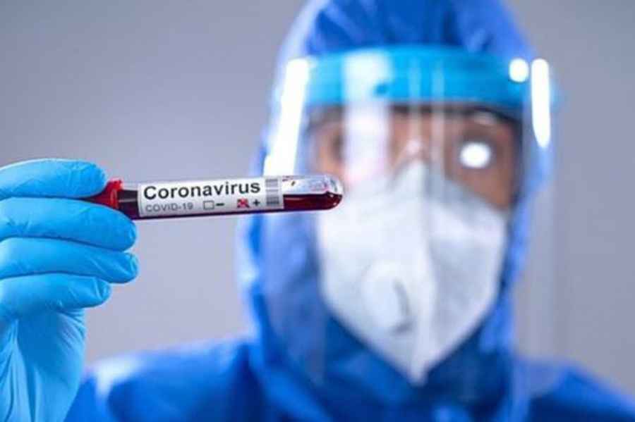 Covid-19: ¿qué grupos sanguíneos tiene mayor riesgo?