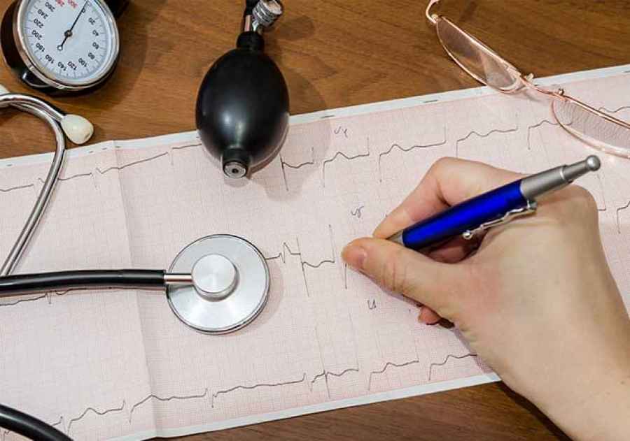 Las personas con fibrilaci&oacute;n auricular (FA) tienen un riesgo mayor de desarrollar co&aacute;gulos en la sangre, lo que aumenta el riesgo de accidente cerebro vascular (ACV) hasta 7 veces. Los &uacute;ltimos 10 a&ntilde;os han visto un avance incre&iacute;ble en anticoagulaci&oacute;n con la disponibilidad de los nuevos agentes anticoagulantes directos (NOAC)