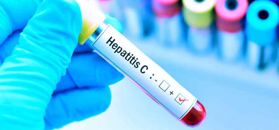 Hepatitis C: salen a buscar a "los millones que faltan"