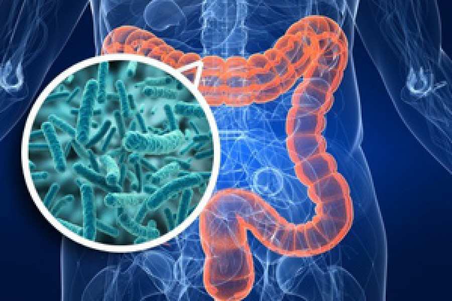 Un probi&oacute;tico reduce la inflamaci&oacute;n y suprime tumores de colon