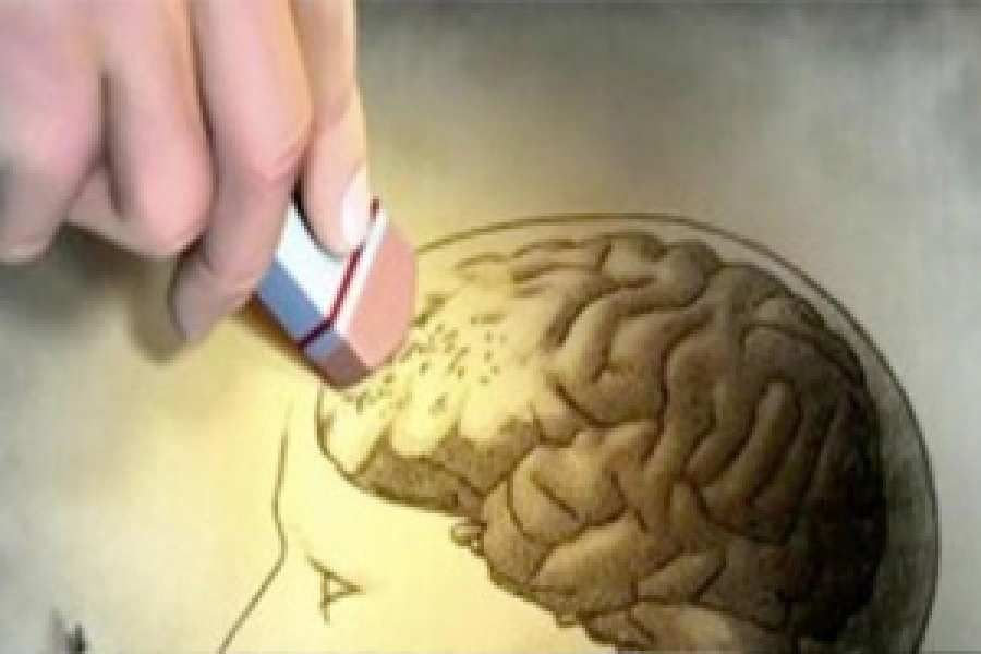 Apnea de sue&ntilde;o, mayor riesgo de Alzheimer