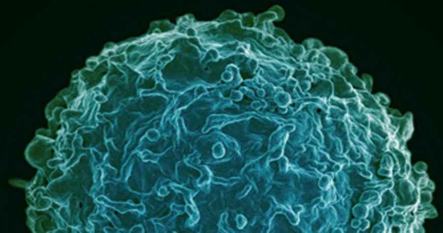 Un estudio publicado en «PLoS Pathogens» apuesta por el uso de cócteles de anticuerpos en entornos clínicos como un medio útil para prevenir y tratar la covid-19.