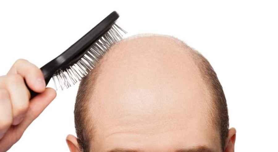 Un fármaco para el eccema, prometedor contra la alopecia
