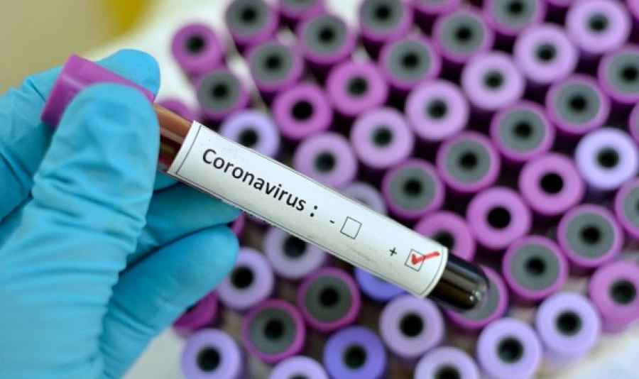Coronavirus: la cura se fragua en la industria con 30 f&aacute;rmacos y 4 vacunas
