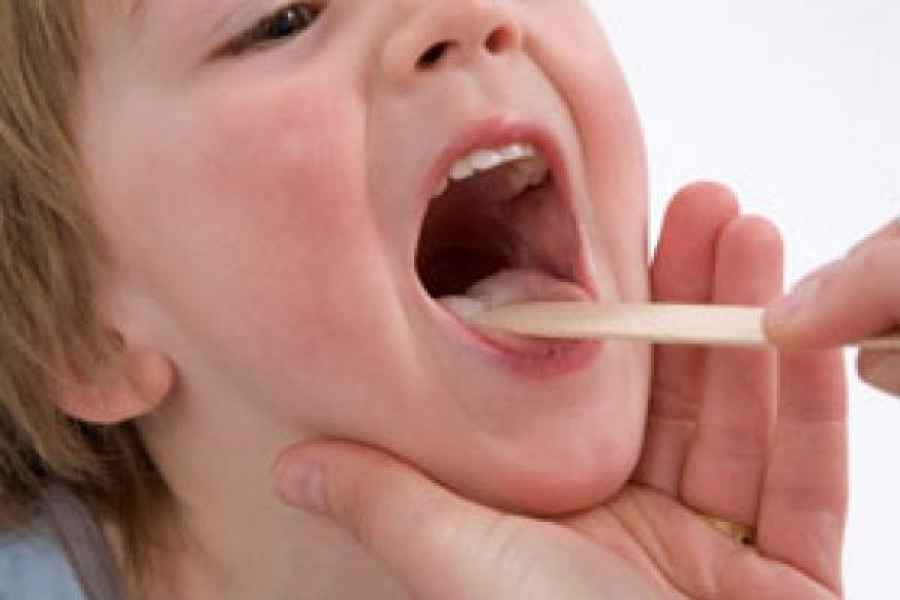 Alerta por el regreso de la difteria a las Am&eacute;ricas