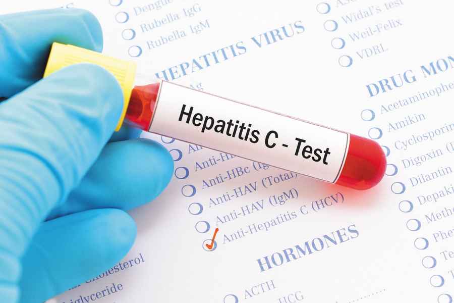 La Hepatitis C comienza a preocupar a otras especialidades médicas