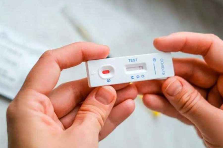 Llegan los autotest a las farmacias para venta al p&uacute;blico