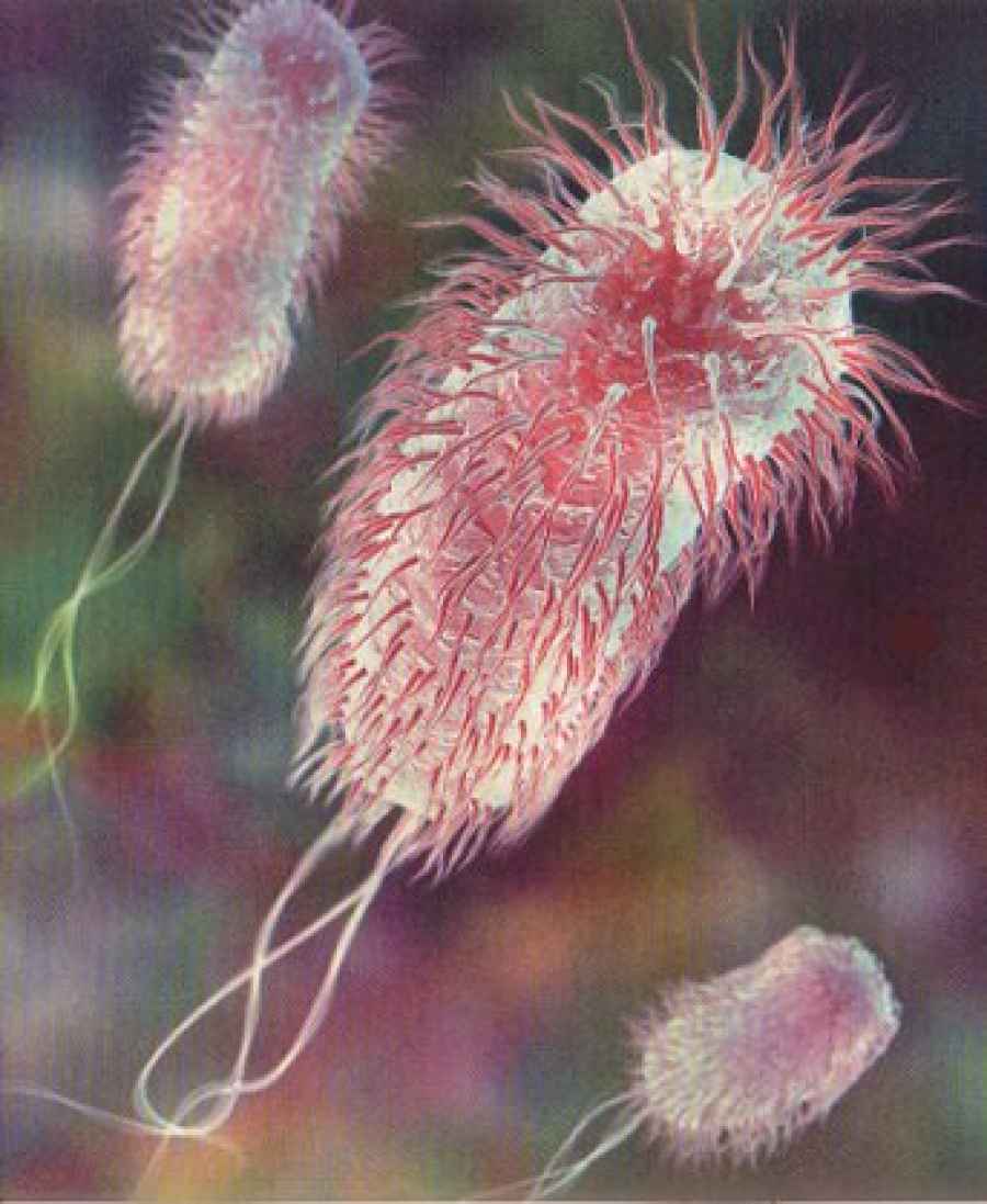 Dirigirse a una molécula bacteriana clave podría reducir la necesidad de antibióticos en infecciones del tracto urinario